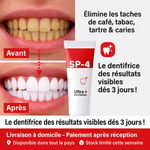 Charger l'image dans la galerie, Dentifrice blanchissant probiotique Gestion de la santé bucco-dentaire
