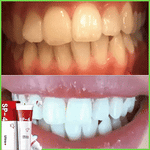 Charger l'image dans la galerie, Dentifrice blanchissant probiotique Gestion de la santé bucco-dentaire
