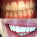 Charger l'image dans la galerie, Dentifrice blanchissant probiotique Gestion de la santé bucco-dentaire
